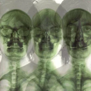 Supergrass